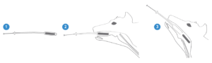 Bolus applicator